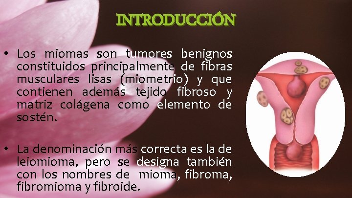 INTRODUCCIÓN • Los miomas son tumores benignos constituidos principalmente de fibras musculares lisas (miometrio)