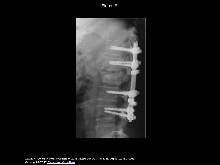 Figure 9 Surgery - Oxford International Edition 2015 33238 -247 DOI: (10. 1016/j. mpsur.