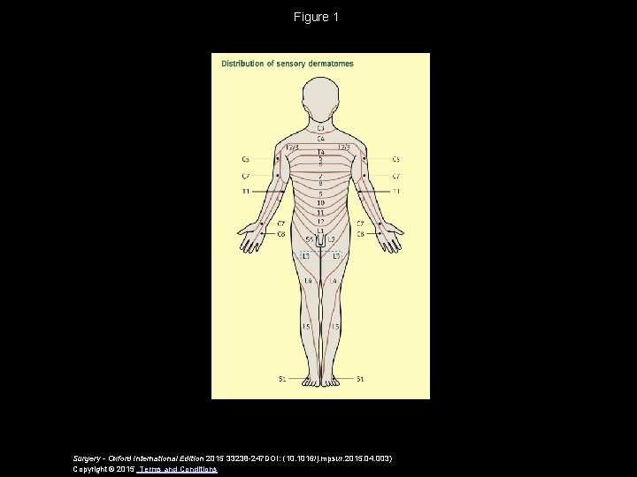 Figure 1 Surgery - Oxford International Edition 2015 33238 -247 DOI: (10. 1016/j. mpsur.