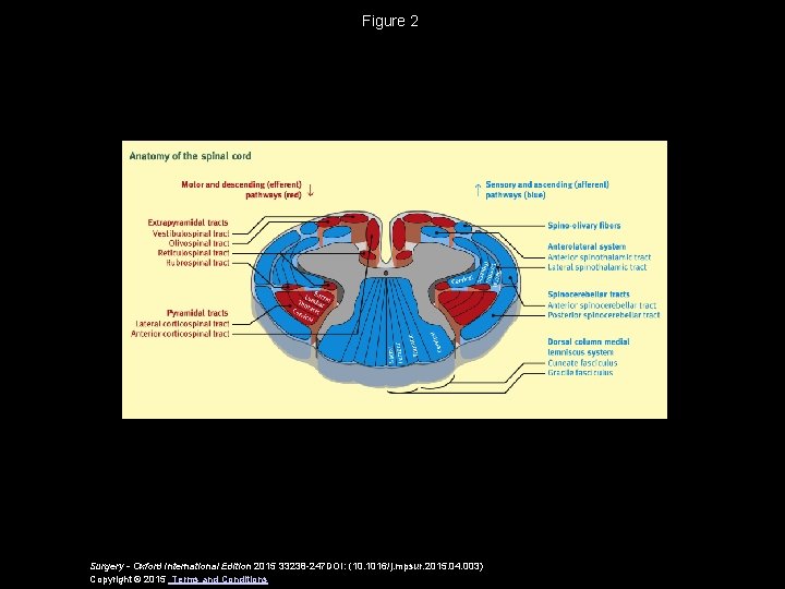 Figure 2 Surgery - Oxford International Edition 2015 33238 -247 DOI: (10. 1016/j. mpsur.