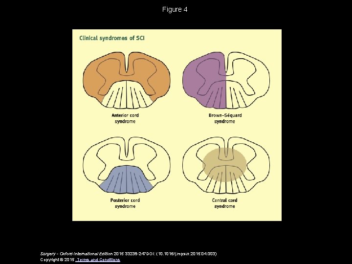 Figure 4 Surgery - Oxford International Edition 2015 33238 -247 DOI: (10. 1016/j. mpsur.