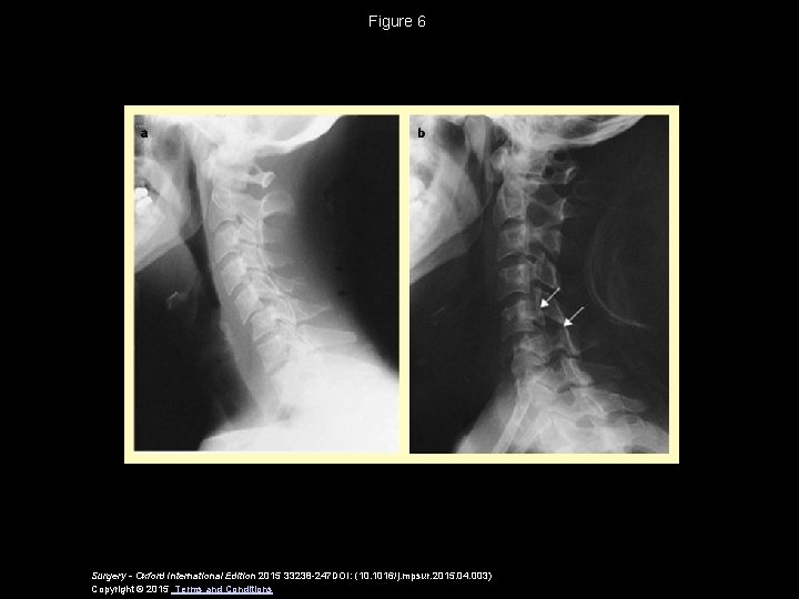 Figure 6 Surgery - Oxford International Edition 2015 33238 -247 DOI: (10. 1016/j. mpsur.