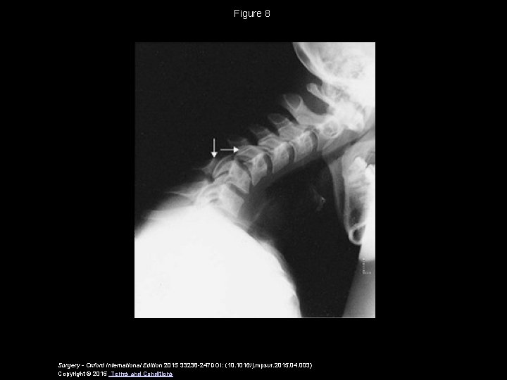 Figure 8 Surgery - Oxford International Edition 2015 33238 -247 DOI: (10. 1016/j. mpsur.