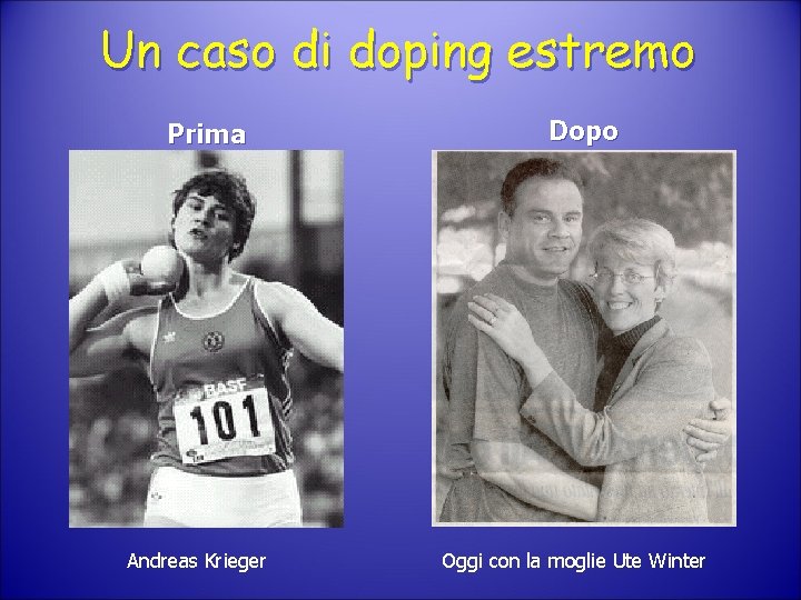 Un caso di doping estremo Prima Andreas Krieger Dopo Oggi con la moglie Ute