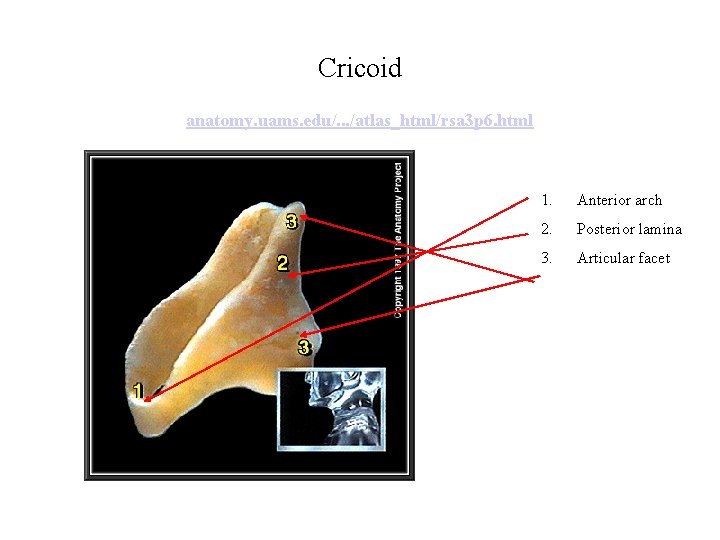 Cricoid anatomy. uams. edu/. . . /atlas_html/rsa 3 p 6. html 1. Anterior arch