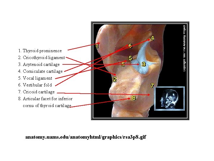 1. Thyroid prominence 2. Cricothyroid ligament 3. Arytenoid cartilage 4. Corniculate cartilage 5. Vocal