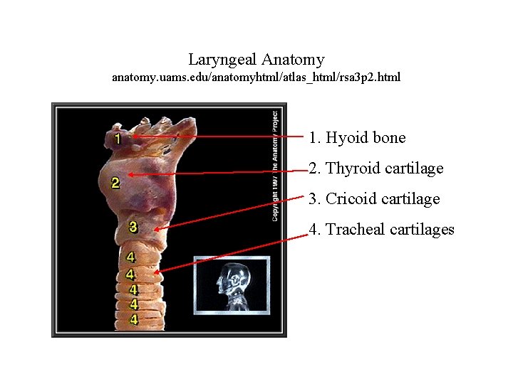 Laryngeal Anatomy anatomy. uams. edu/anatomyhtml/atlas_html/rsa 3 p 2. html 1. Hyoid bone 2. Thyroid