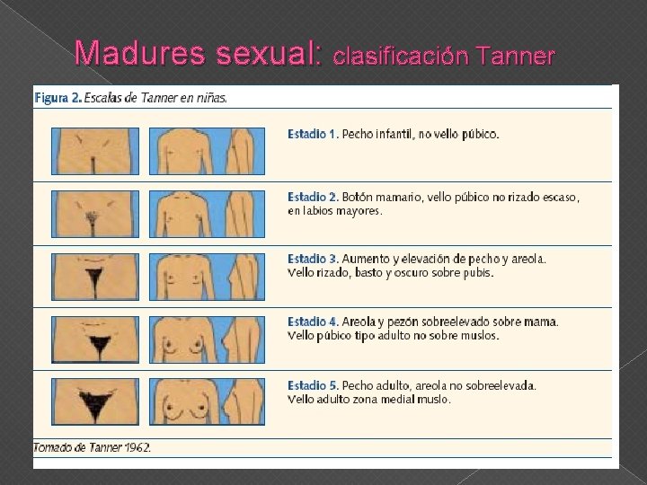 Madures sexual: clasificación Tanner 