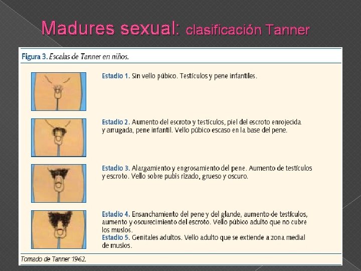 Madures sexual: clasificación Tanner 