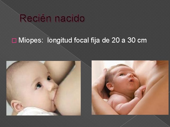 Recién nacido � Miopes: longitud focal fija de 20 a 30 cm 