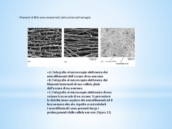 I filamenti di GFA sono caratteristici delle cellule dell’astroglia. • A) Fotografia al microscopio