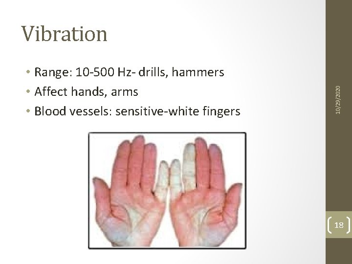  • Range: 10 -500 Hz- drills, hammers • Affect hands, arms • Blood