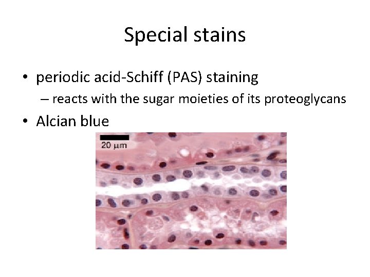 Special stains • periodic acid-Schiff (PAS) staining – reacts with the sugar moieties of
