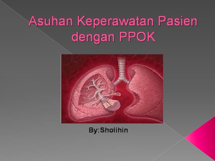 Asuhan Keperawatan Pasien dengan PPOK By: Sholihin 