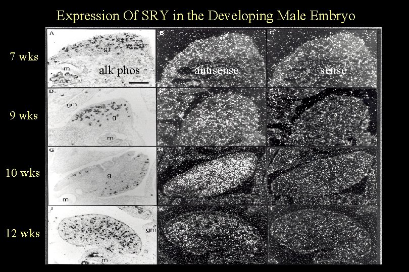 Expression Of SRY in the Developing Male Embryo 7 wks alk phos 9 wks