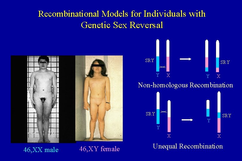 Recombinational Models for Individuals with Genetic Sex Reversal SRY Y X Non-homologous Recombination SRY