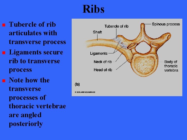 Ribs n n n Tubercle of rib articulates with transverse process Ligaments secure rib