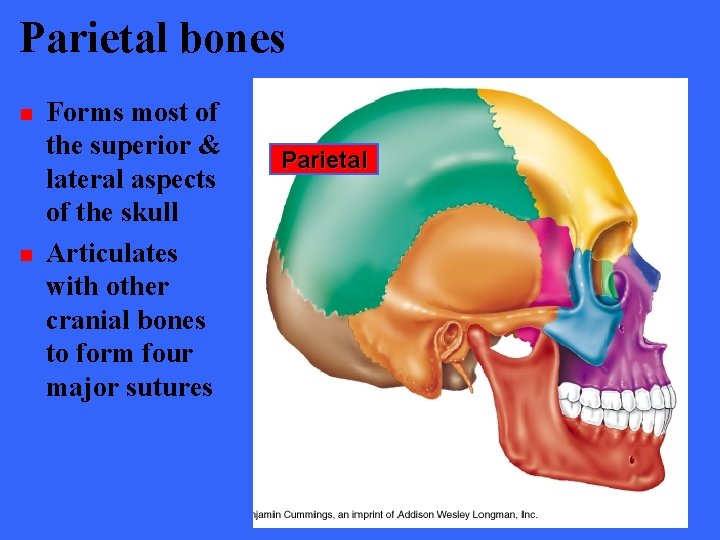 Parietal bones n n Forms most of the superior & lateral aspects of the