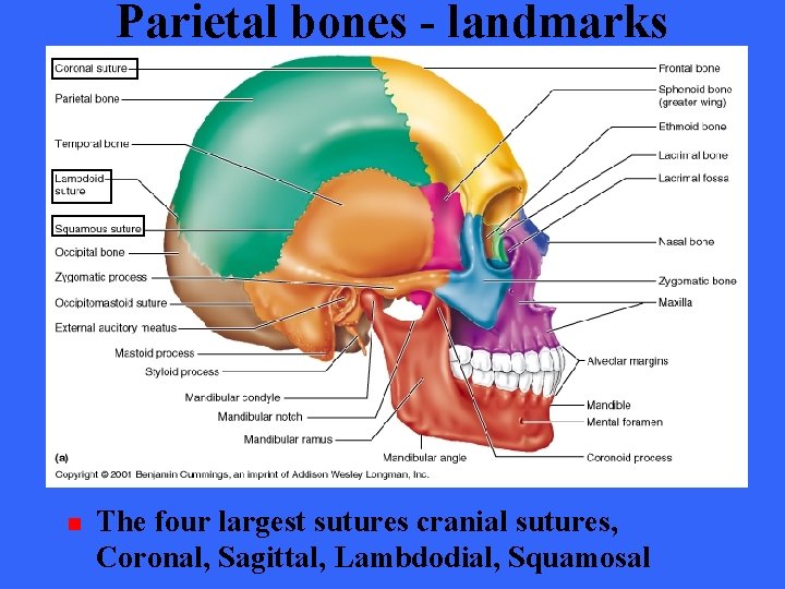 Parietal bones - landmarks n The four largest sutures cranial sutures, Coronal, Sagittal, Lambdodial,