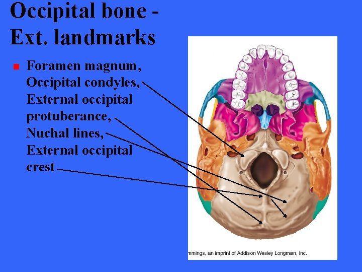 Occipital bone Ext. landmarks n Foramen magnum, Occipital condyles, External occipital protuberance, Nuchal lines,