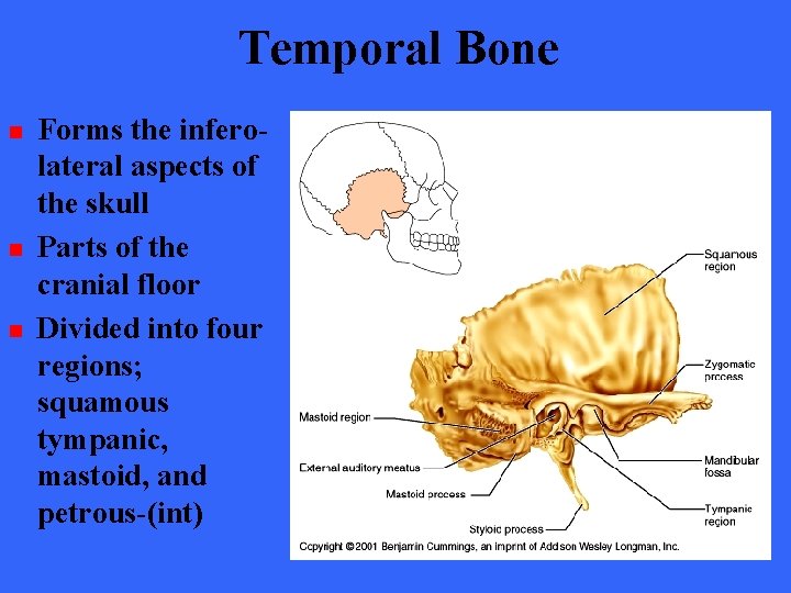 Temporal Bone n n n Forms the inferolateral aspects of the skull Parts of