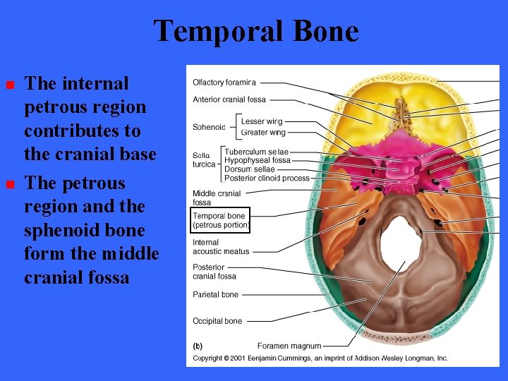 Temporal Bone n n The internal petrous region contributes to the cranial base The