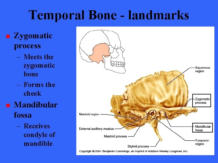 Temporal Bone - landmarks n Zygomatic process – Meets the zygomatic bone – Forms