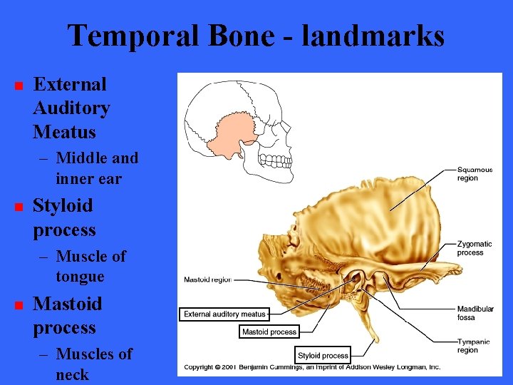 Temporal Bone - landmarks n External Auditory Meatus – Middle and inner ear n