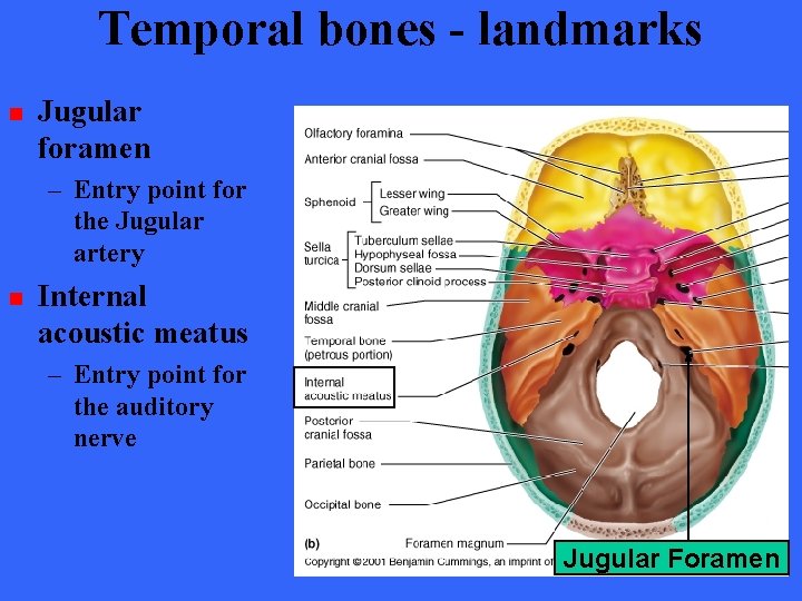 Temporal bones - landmarks n Jugular foramen – Entry point for the Jugular artery