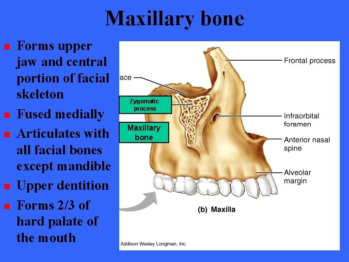 Maxillary bone n n n Forms upper jaw and central portion of facial skeleton