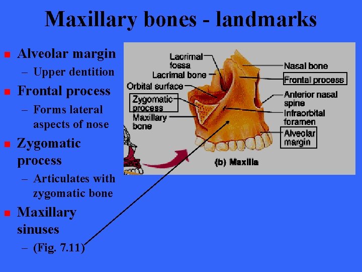 Maxillary bones - landmarks n Alveolar margin – Upper dentition n Frontal process –