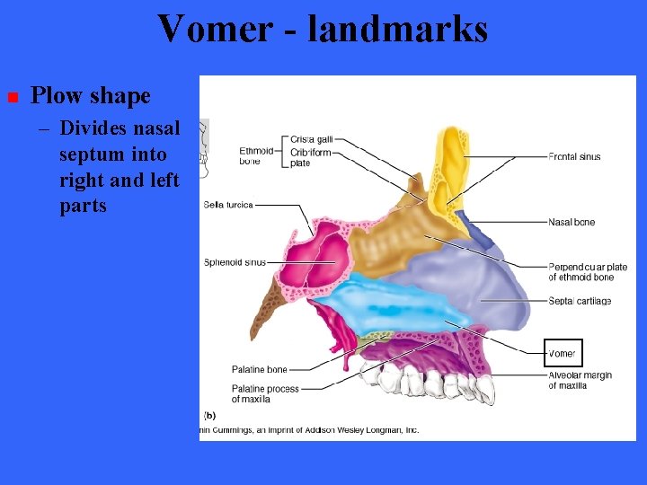 Vomer - landmarks n Plow shape – Divides nasal septum into right and left