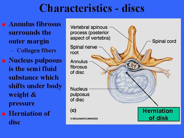 Characteristics - discs n Annulus fibrosus surrounds the outer margin – Collagen fibers n