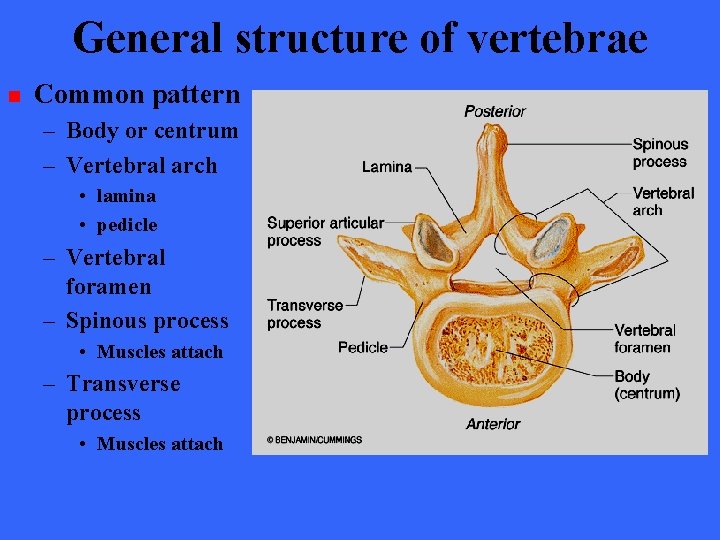 General structure of vertebrae n Common pattern – Body or centrum – Vertebral arch