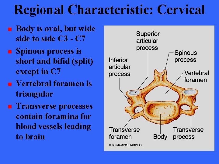 Regional Characteristic: Cervical n n Body is oval, but wide side to side C