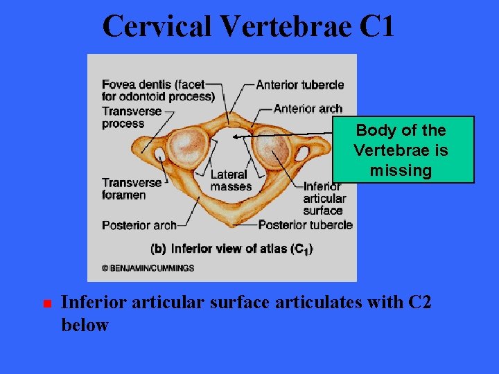 Cervical Vertebrae C 1 Body of the Vertebrae is missing n Inferior articular surface