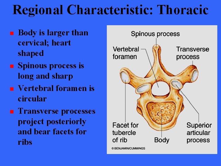 Regional Characteristic: Thoracic n n Body is larger than cervical; heart shaped Spinous process