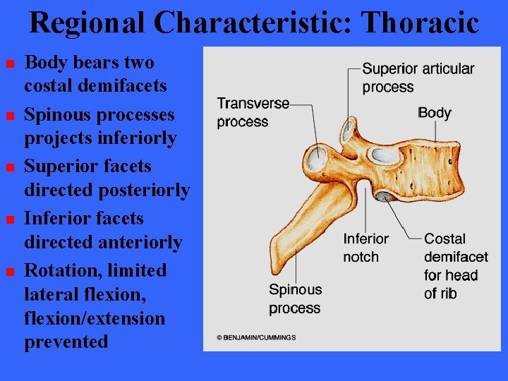 Regional Characteristic: Thoracic n n n Body bears two costal demifacets Spinous processes projects