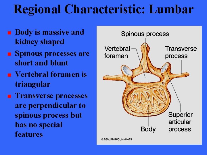 Regional Characteristic: Lumbar n n Body is massive and kidney shaped Spinous processes are