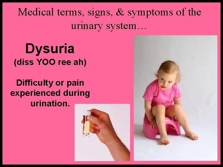 Medical terms, signs, & symptoms of the urinary system… Dysuria (diss YOO ree ah)