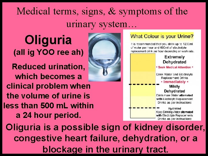 Medical terms, signs, & symptoms of the urinary system… Oliguria (all ig YOO ree