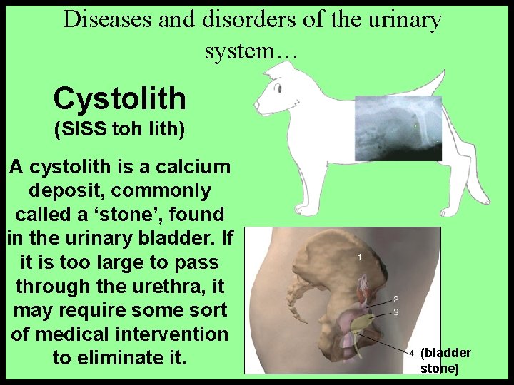 Diseases and disorders of the urinary system… Cystolith (SISS toh lith) A cystolith is