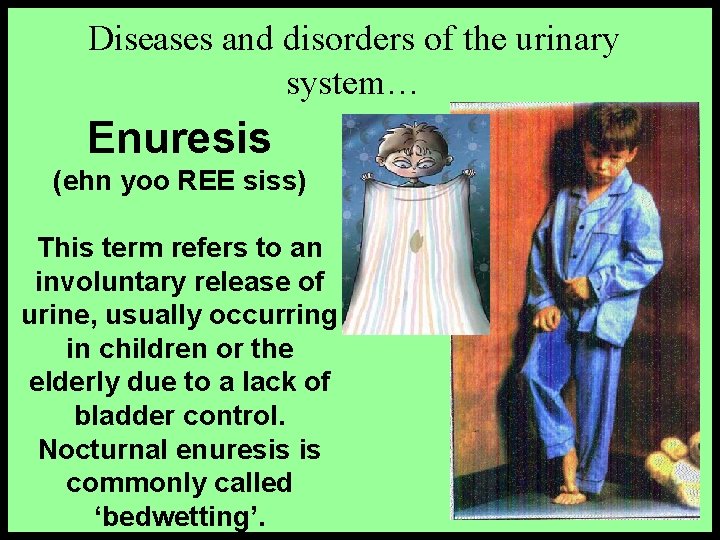 Diseases and disorders of the urinary system… Enuresis (ehn yoo REE siss) This term