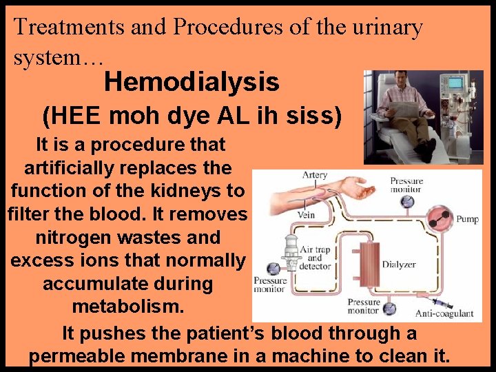 Treatments and Procedures of the urinary system… Hemodialysis (HEE moh dye AL ih siss)