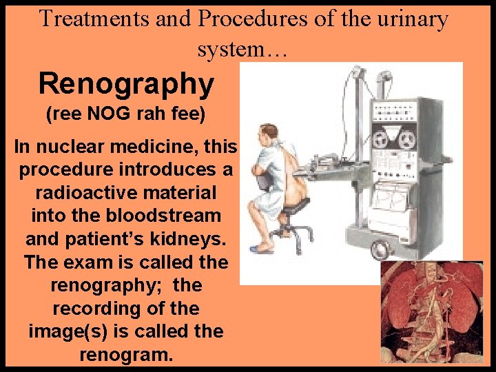 Treatments and Procedures of the urinary system… Renography (ree NOG rah fee) In nuclear