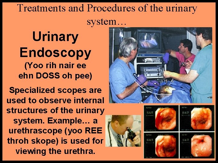 Treatments and Procedures of the urinary system… Urinary Endoscopy (Yoo rih nair ee ehn