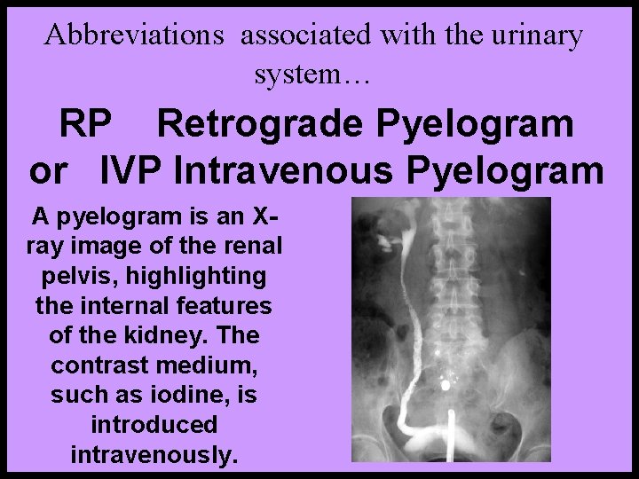 Abbreviations associated with the urinary system… RP Retrograde Pyelogram or IVP Intravenous Pyelogram A