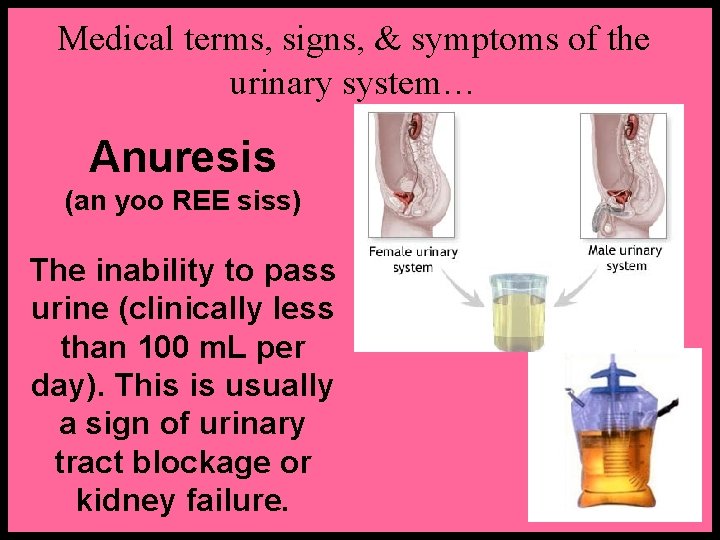 Medical terms, signs, & symptoms of the urinary system… Anuresis (an yoo REE siss)