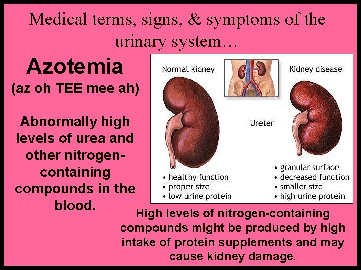 Medical terms, signs, & symptoms of the urinary system… Azotemia (az oh TEE mee