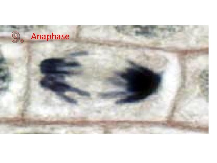 9. Anaphase 